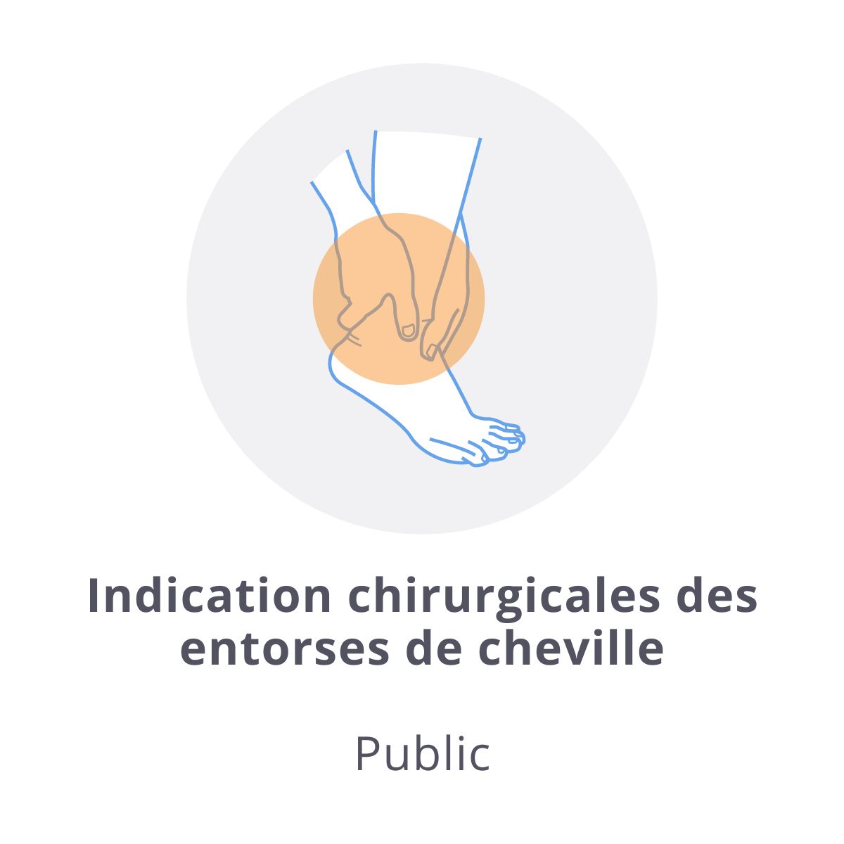 Lire la suite à propos de l’article Indication chirurgicales des entorses de cheville, quoi de neuf en 2022 ? 